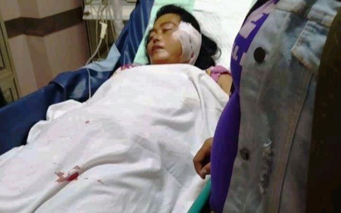Satu Terapis Tewas Digorok, Satu Lagi Luka Berat Satu Terapis Tewas Digorok, Satu Lagi Luka Berat