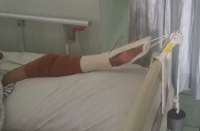 Karena Malu Anak Pincang Dihajar Bapak Hingga Patah Tulang