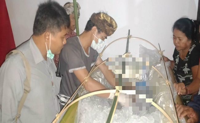Kenali Gejala Kanker Lidah Yang Mirip Dengan Sariawan