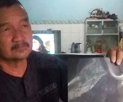Berkelahi Di Sekolah Siswa Smp Kena Gangguan Saraf Lapor Ke Polisi